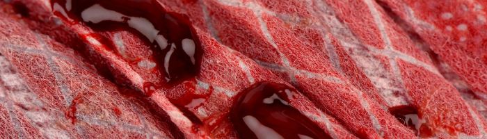 Period Clots: What's Normal and When to See a Doctor